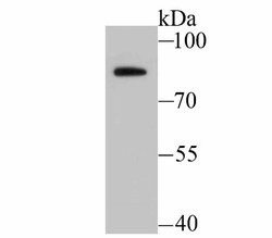 Bradykinin RB2/BDKRB2 Rabbit anti-Human, Mouse, Clone: JU39-04, Novus Biologicals